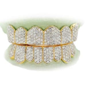 Prong Set Diamond Grillz